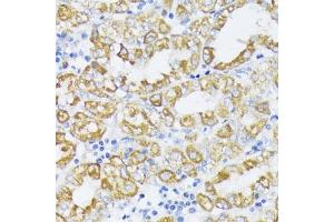 Immunohistochemistry of paraffin-embedded human stomach using SLC30 antibody (2532) at dilution of 1:100 (40x lens). (SLC30A1 Antikörper  (AA 250-350))