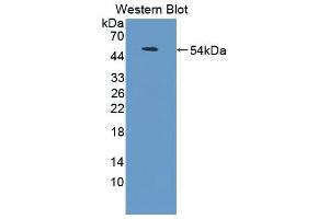 Western blot analysis of the recombinant protein. (CD58 Antikörper  (AA 1-214))