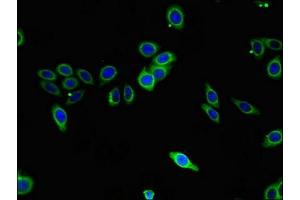Immunofluorescence (IF) image for anti-Sphingosine Kinase 1 (SPHK1) (AA 1-384) antibody (ABIN7170581)