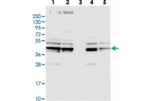 Western blot analysis of Lane 1: RT-4, Lane 2: U-251 MG, Lane 3: Human Plasma, Lane 4: Liver, Lane 5: Tonsil with SUCLA2 polyclonal antibody . (SUCLA2 Antikörper)