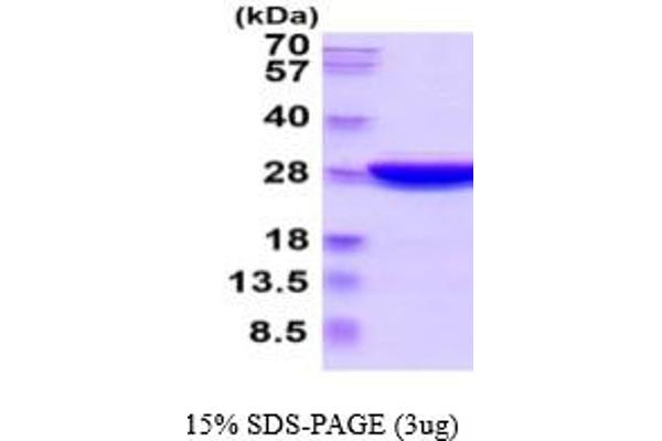 UCHL3 Protein (AA 1-230) (His tag)