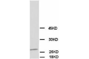 Image no. 1 for anti-Calbindin (CALB1) antibody (ABIN1502005)