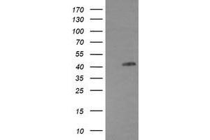Image no. 1 for anti-Epidermal Growth Factor Receptor (EGFR) antibody (ABIN1497964) (EGFR Antikörper)