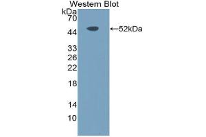 Western blot analysis of the recombinant protein. (TLR10 Antikörper  (AA 617-784))