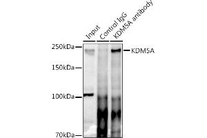 Immunoprecipitation analysis of 300 μg extracts of HeLa cells using 3 μg KDM5A antibody (ABIN6131816, ABIN6142800, ABIN6142801 and ABIN6223074). (KDM5A Antikörper)