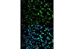 Immunofluorescence analysis of HeLa cell using TYMP antibody. (Thymidine Phosphorylase Antikörper  (AA 1-200))