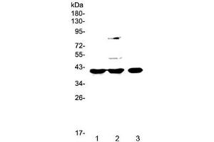 Western blot testing of 1) rat spleen, 2) rat liver and 3) mouse testis lysate with PPID antibody at 0. (PPID Antikörper)