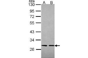 WB Image Sample (30 ug of whole cell lysate) A: 293T B: A431 , 12% SDS PAGE antibody diluted at 1:2000 (SLA Antikörper)