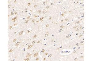 Immunohistochemistry analysis of paraffin-embedded rat brain using RBFOX3 Polyclonal Antibody at dilution of 1:300. (NeuN Antikörper)