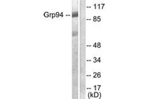 Western blot analysis of extracts from SKOV3 cells, using GRP94 Antibody. (GRP94 Antikörper  (AA 754-803))