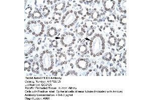 Immunohistochemistry (IHC) image for anti-Cbp/p300-Interacting Transactivator, with Glu/Asp-Rich Carboxy-terminal Domain, 1 (CITED1) (Middle Region) antibody (ABIN2777537)