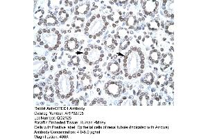 Human kidney (CITED1 Antikörper  (Middle Region))