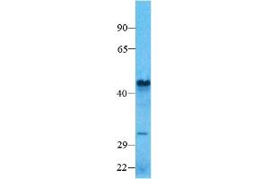 Host:  Rabbit  Target Name: SMAD7    Sample Type:  Human Lung  Antibody Dilution:  1. (SMAD7 Antikörper  (N-Term))