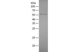 Western Blotting (WB) image for Dihydropyrimidinase-Like 5 (DPYSL5) (AA 1-564) protein (His tag) (ABIN7288531) (DPYSL5 Protein (AA 1-564) (His tag))