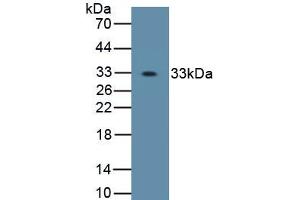 Detection of Recombinant OSX, Human using Polyclonal Antibody to Osterix (OSX) (SP7 Antikörper  (AA 19-288))