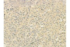 ABIN6260771 and ABIN6279279 at 1/100 staining human pituitary adenoma by IHC-P. (CEP72 Antikörper)