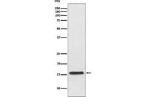 Western blot analysis of VAMP2 expression in mouse brain lysate. (Rekombinanter VAMP2 Antikörper)