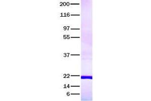 Validation with Western Blot (RANKL Protein)