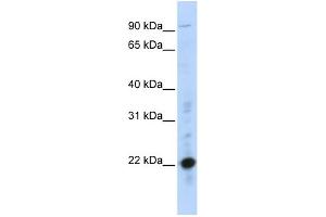 WB Suggested Anti-CRIP2 Antibody Titration:  0. (CRIP2 Antikörper  (Middle Region))