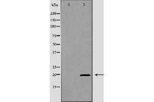Western blot analysis of extracts of K562, using KLRD1 antibody.