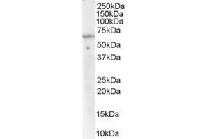 Western Blotting (WB) image for anti-ATPase, Cu++ Transporting, alpha Polypeptide (ATP7A) (Middle Region) antibody (ABIN2781761) (ATP7A Antikörper  (Middle Region))