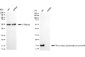 Western blotting analysis using vesicle associated membrane protein 8 antibody (ABIN7800832).