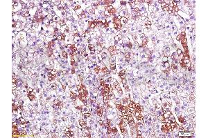 Formalin-fixed and paraffin embedded rat kidney labeled with Anti-CD200R/Orexin receptor Polyclonal Antibody, Unconjugated (ABIN737586) at 1:200 followed by conjugation to the secondary antibody and DAB staining.
