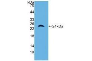 Detection of Recombinant a1M, Mouse using Polyclonal Antibody to Alpha-1-Microglobulin (a1M) (AMBP Antikörper  (AA 18-202))