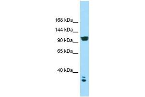 WB Suggested Anti-CACNA2D2 Antibody Titration: 1. (CACNA2D2 Antikörper  (C-Term))