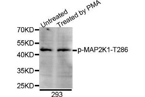 Western blot analysis of extracts of 293 cell line, using Phospho-MAP2K1-T286 antibody. (MEK1 Antikörper  (pThr285))