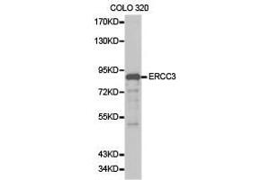 Western Blotting (WB) image for anti-DNA Repair Protein Complementing XP-B Cells (ERCC3) antibody (ABIN1872578) (ERCC3 Antikörper)