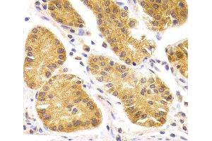 Immunohistochemistry of paraffin-embedded Human stomach using SCO2 Polyclonal Antibody at dilution of 1:100 (40x lens). (SCO2 Antikörper)