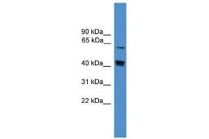 WB Suggested Anti-EIF2AK2  Antibody Titration: 0. (EIF2AK2 Antikörper  (Middle Region))