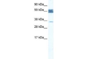 WB Suggested Anti-ZNF713 Antibody Titration:  1.
