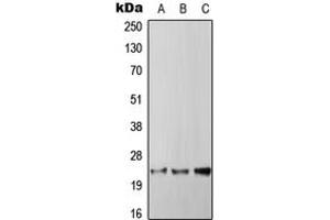 Western blot analysis of RGS4 expression in HepG2 (A), SP2/0 (B), PC12 (C) whole cell lysates.