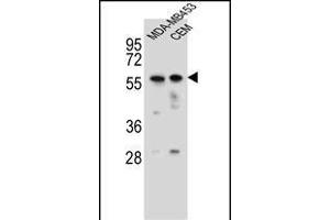 FOXD4 Antibody (Center) (ABIN656115 and ABIN2845454) western blot analysis in MDA-M,CEM cell line lysates (35 μg/lane).