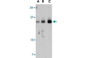 Western blot analysis of FABP7 in human breast tissue lysate with FABP7 polyclonal antibody  at (A) 0. (FABP7 Antikörper  (Internal Region))