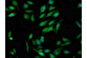 Immunofluorescence (IF) image for anti-RAB3 GTPase Activating Protein Subunit 1 (Catalytic) (RAB3GAP1) (AA 527-653), (Catalytic Subunit) antibody (ABIN7166993)