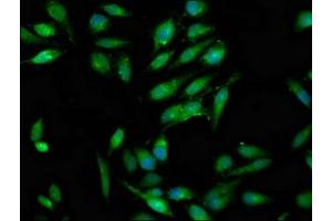 Immunofluorescence staining of Hela cells with ABIN7166993 at 1:100, counter-stained with DAPI. (RAB3GAP1 Antikörper  (Catalytic Subunit))