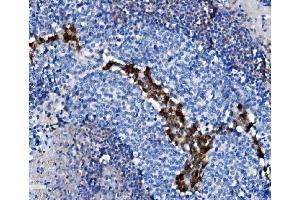 IHC analysis of CD38 using anti-CD38 antibody (ABIN7602815). (CD38 Antikörper  (C-Term))
