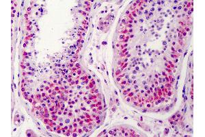 Anti-NEK2 antibody IHC of human testis. (NEK2 Antikörper  (AA 287-299))