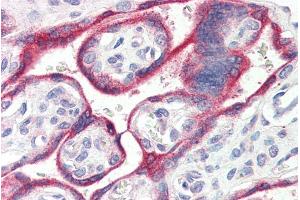 Immunohistochemistry (IHC) image for anti-Cytochrome P450, Family 19, Subfamily A, Polypeptide 1 (CYP19A1) (Internal Region) antibody (ABIN238672)