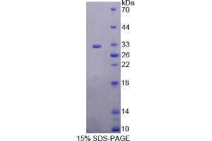 Image no. 1 for Kallikrein 2 (KLK2) (AA 19-261) protein (His tag) (ABIN6236957) (Kallikrein 2 Protein (KLK2) (AA 19-261) (His tag))