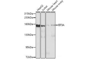 Western blot analysis of extracts of various cell lines using EIF3A Polyclonal Antibody at dilution of 1:1000. (EIF3A Antikörper)