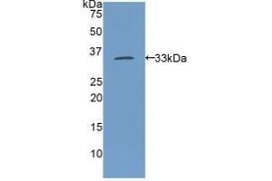 Detection of Recombinant MYH11, Rat using Polyclonal Antibody to Myosin Heavy Chain 11, Smooth Muscle (MYH11) (MYH11 Antikörper  (AA 211-482))