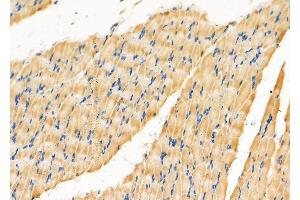 ABIN6258198 and ABIN6276024 at 1/100 staining Rat muscle tissue by IHC-P.