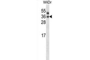Western Blotting (WB) image for anti-Patatin-Like phospholipase Domain Containing 4 (PNPLA4) antibody (ABIN2997649) (PNPLA4 Antikörper)