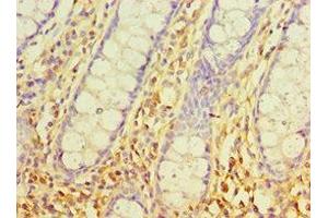 Immunohistochemistry of paraffin-embedded human colon tissue using ABIN7170540 at dilution of 1:100 (Spermidine Synthase Antikörper  (AA 1-302))