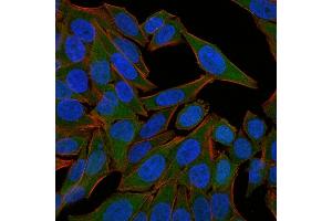 Immunofluorescence (IF) image for anti-Fascin (FSCN1) antibody (ABIN6940609)