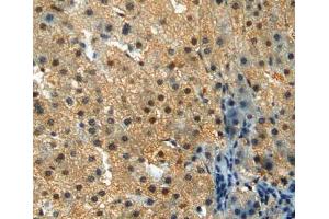 Immunohistochemistry (IHC) image for anti-Creatine Kinase, Muscle (CKM) (AA 11-367) antibody (ABIN1172308)
